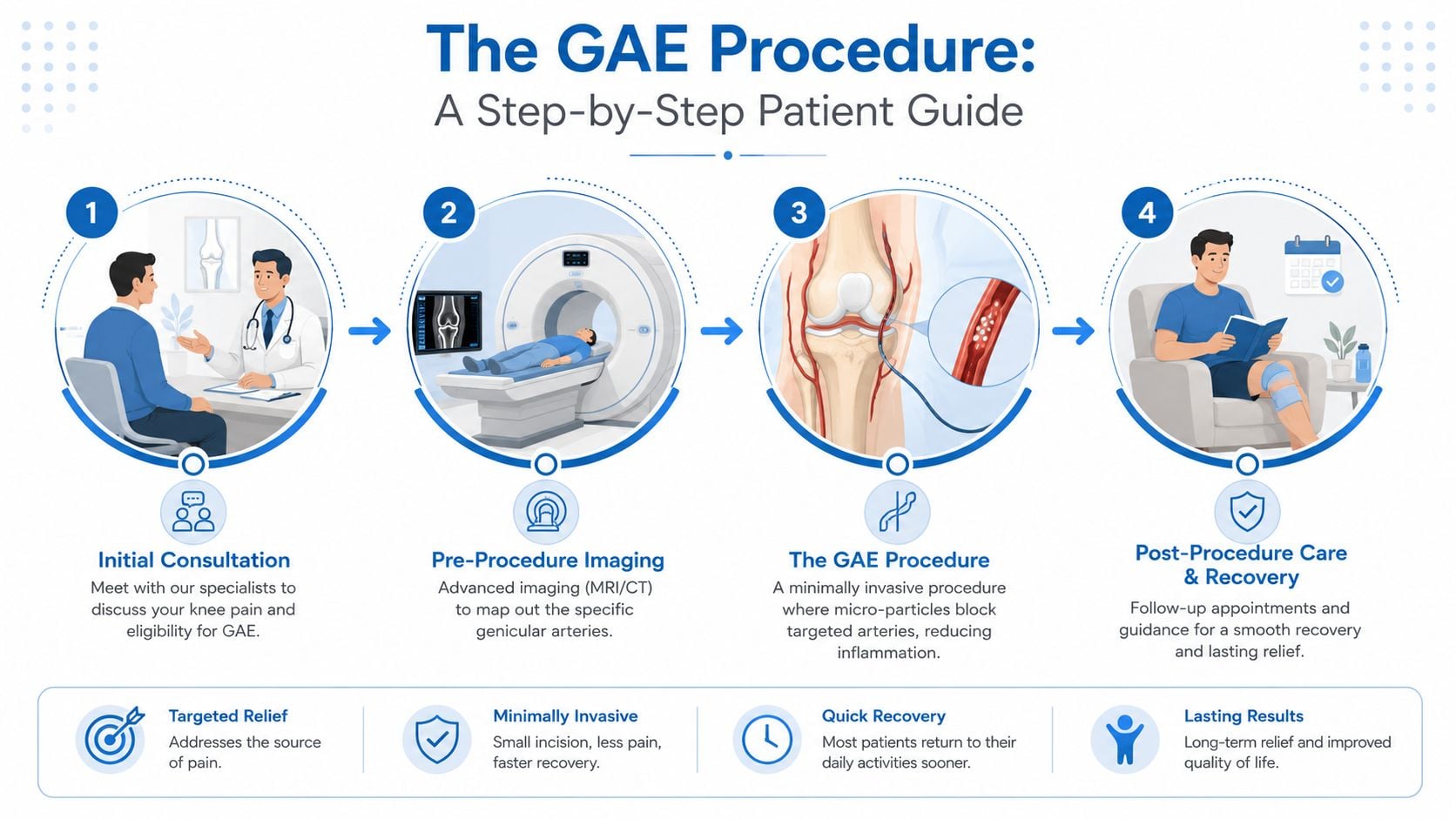 A four-step infographic explaining the Genicular Artery Embolization (GAE) procedure for patients with knee pain.