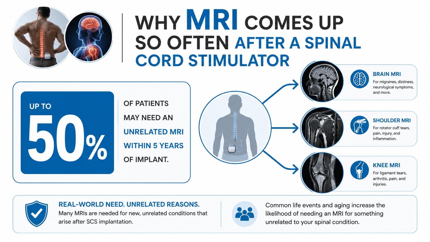 An infographic explaining why many patients with spinal cord stimulators may require unrelated MRI scans within five years of implant.