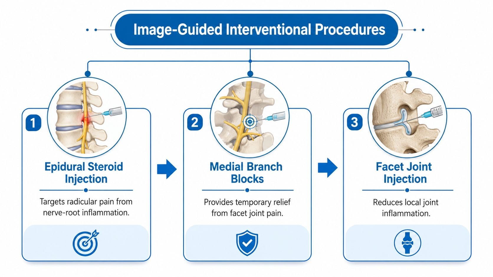 An infographic illustrating three common image-guided interventional pain management procedures for spinal conditions.