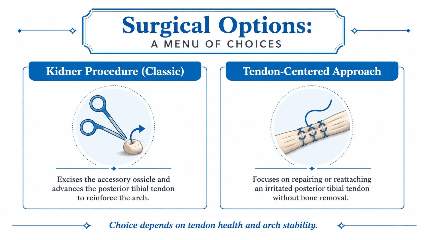 An infographic comparing the Kidner procedure and tendon-centered approach for treating accessory navicular syndrome.