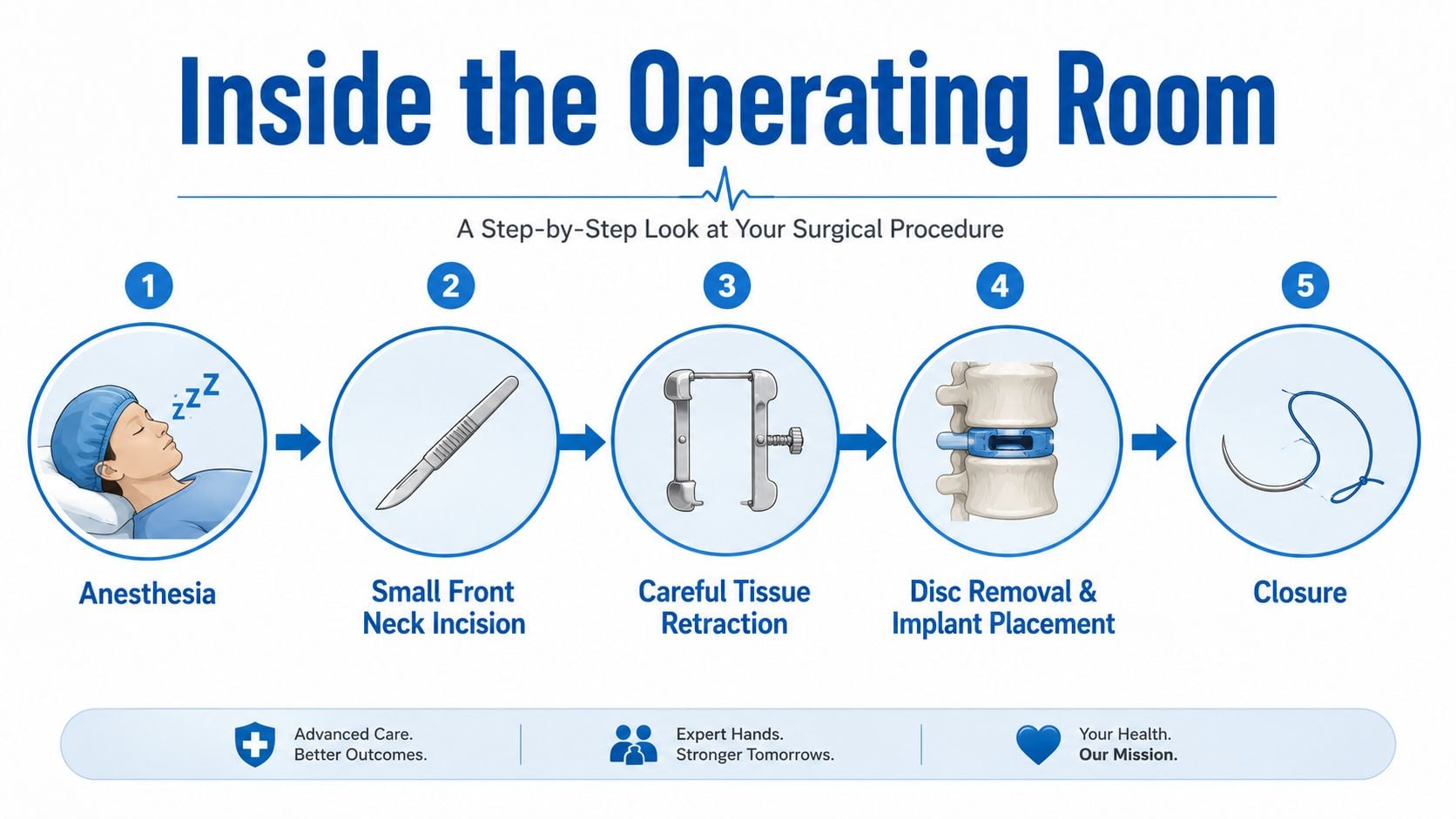 A five-step infographic illustrating the ACDF spine surgery process from anesthesia to final wound closure.