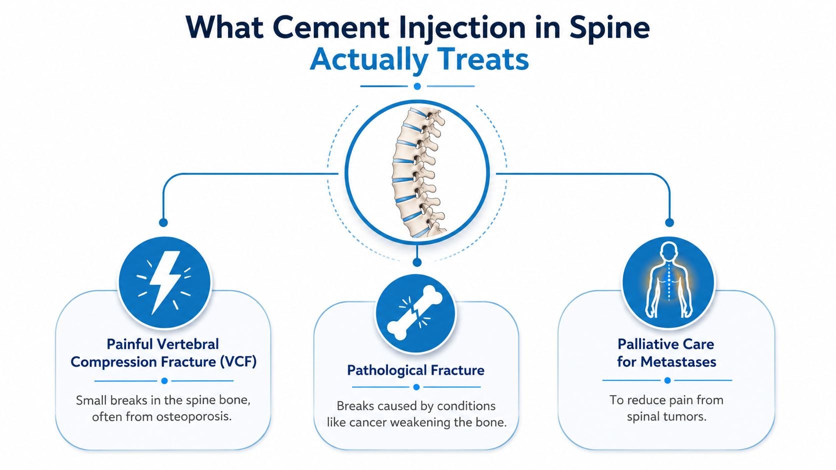 An infographic showing that spine cement injection treats painful vertebral compression fractures, pathological fractures, and cancer-related metastasis.