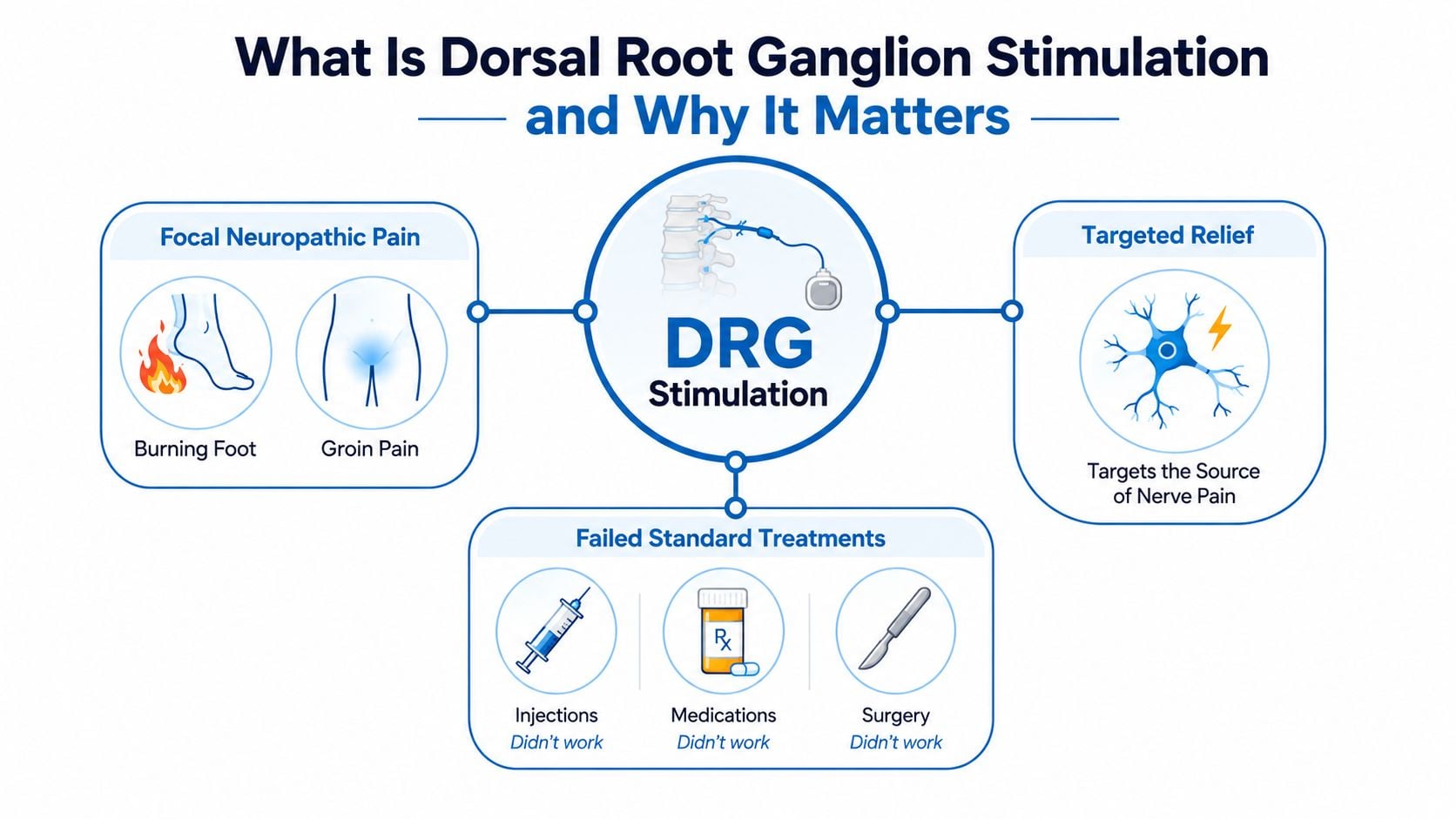 A diagram explaining dorsal root ganglion stimulation as a targeted treatment for focal neuropathic pain when standard options fail.
