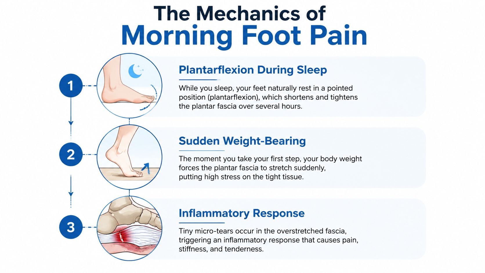 A diagram explaining the mechanics of morning foot pain through three sequential steps involving plantarflexion and inflammation.