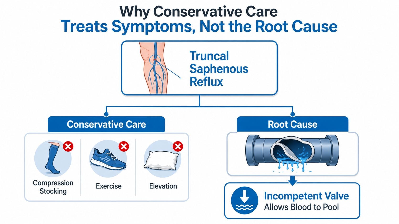 A diagram comparing conservative care for varicose veins versus treating the root cause of incompetent valves.