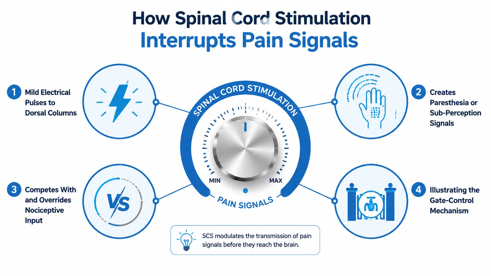 A diagram explaining how spinal cord stimulation uses electrical pulses to interrupt pain signals in the body.