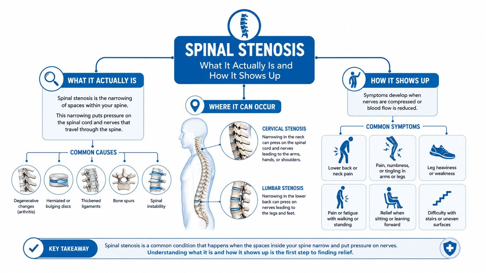 An infographic explaining spinal stenosis, detailing its causes, common locations, symptoms, and key takeaways for patients.