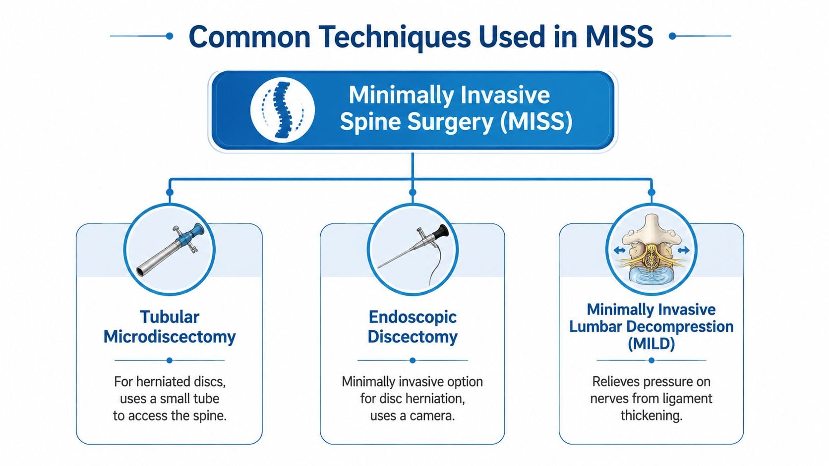 A diagram illustrating common techniques for Minimally Invasive Spine Surgery, including tubular microdiscectomy, endoscopic discectomy, and MILD.
