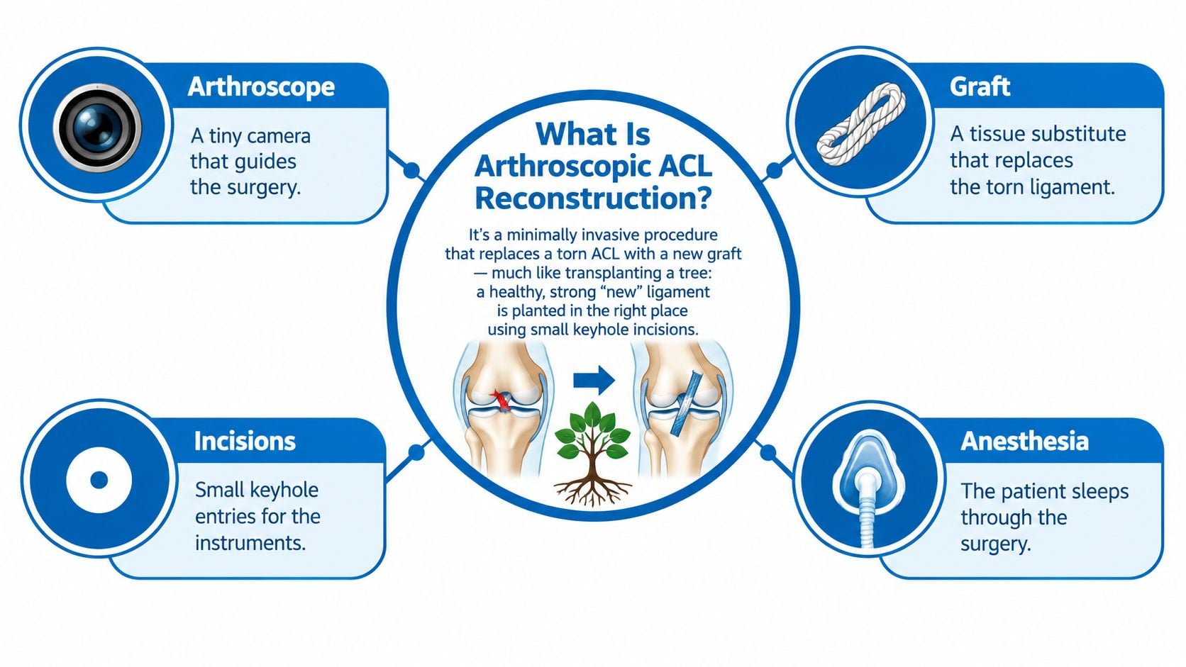An infographic explaining Arthroscopic ACL reconstruction, detailing the use of an arthroscope, graft, incisions, and anesthesia.