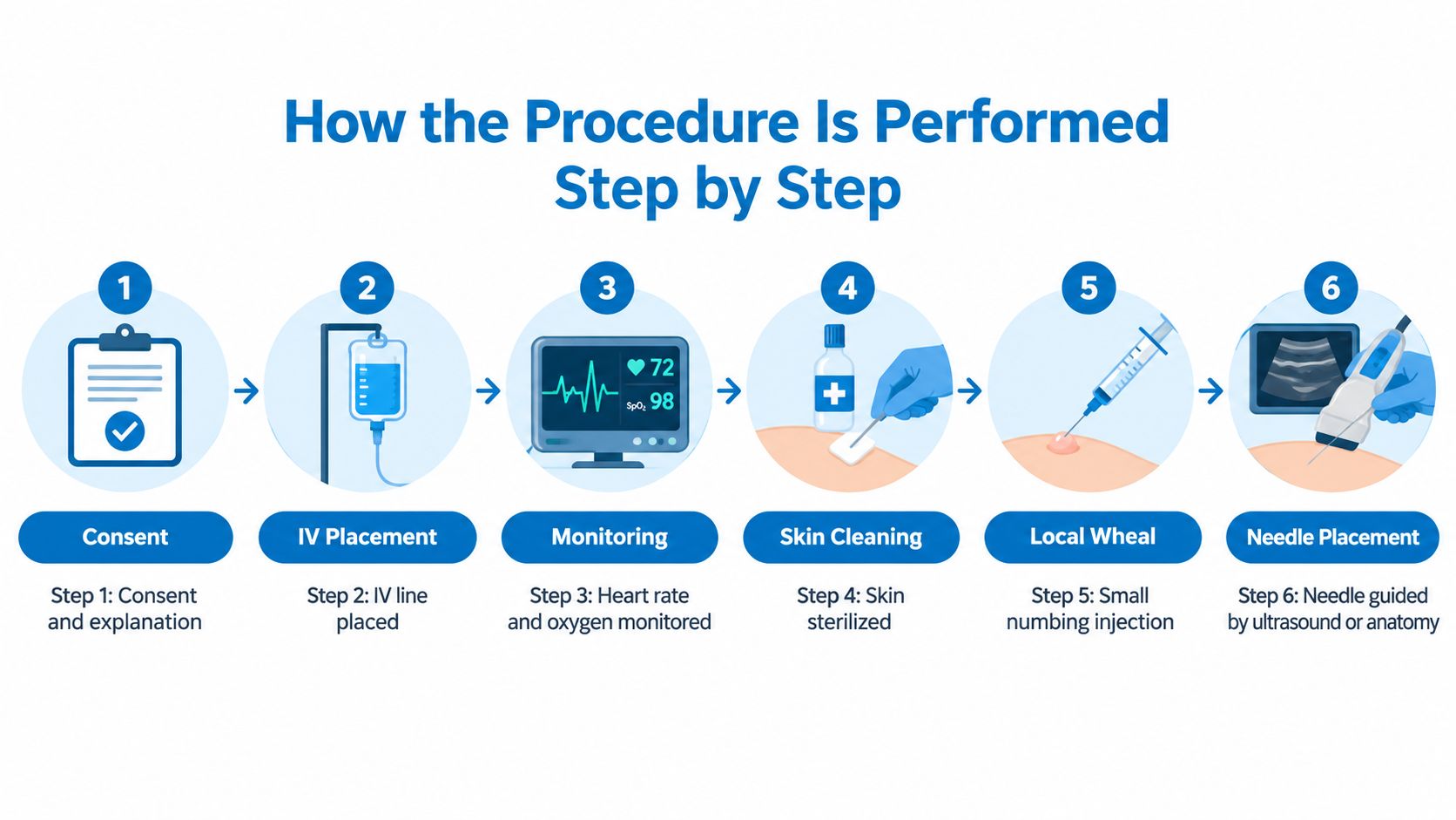 A six-step infographic showing the medical procedure workflow from patient consent to ultrasound guided needle placement.