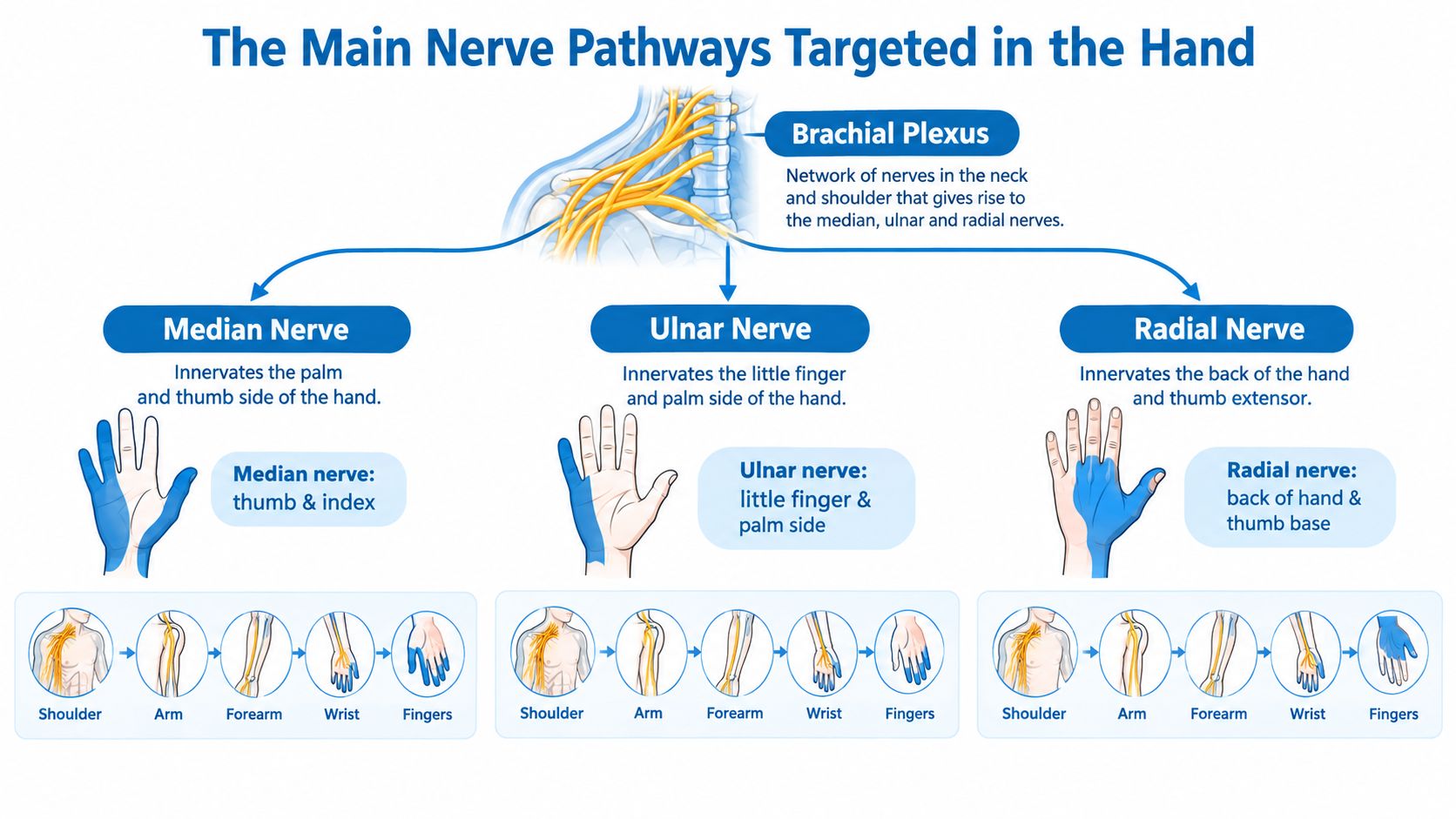 An educational infographic illustrating the brachial plexus nerve branching into the median, ulnar, and radial nerves of the hand.