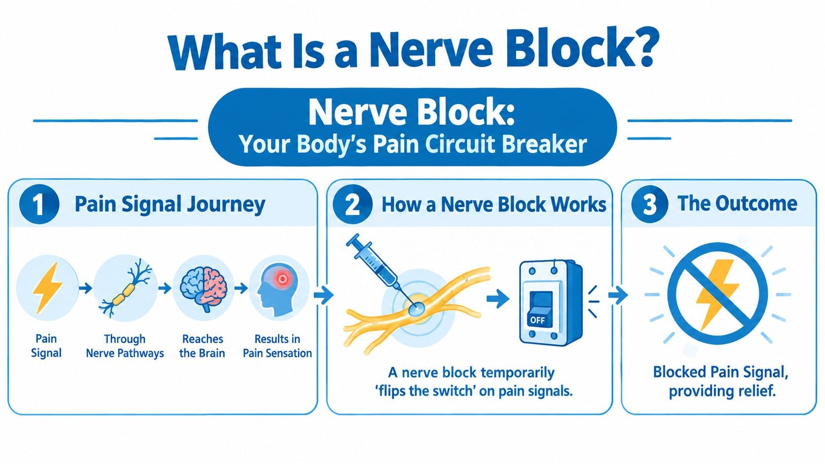 A diagram illustrating how a nerve block functions to intercept and stop pain signals in the body.