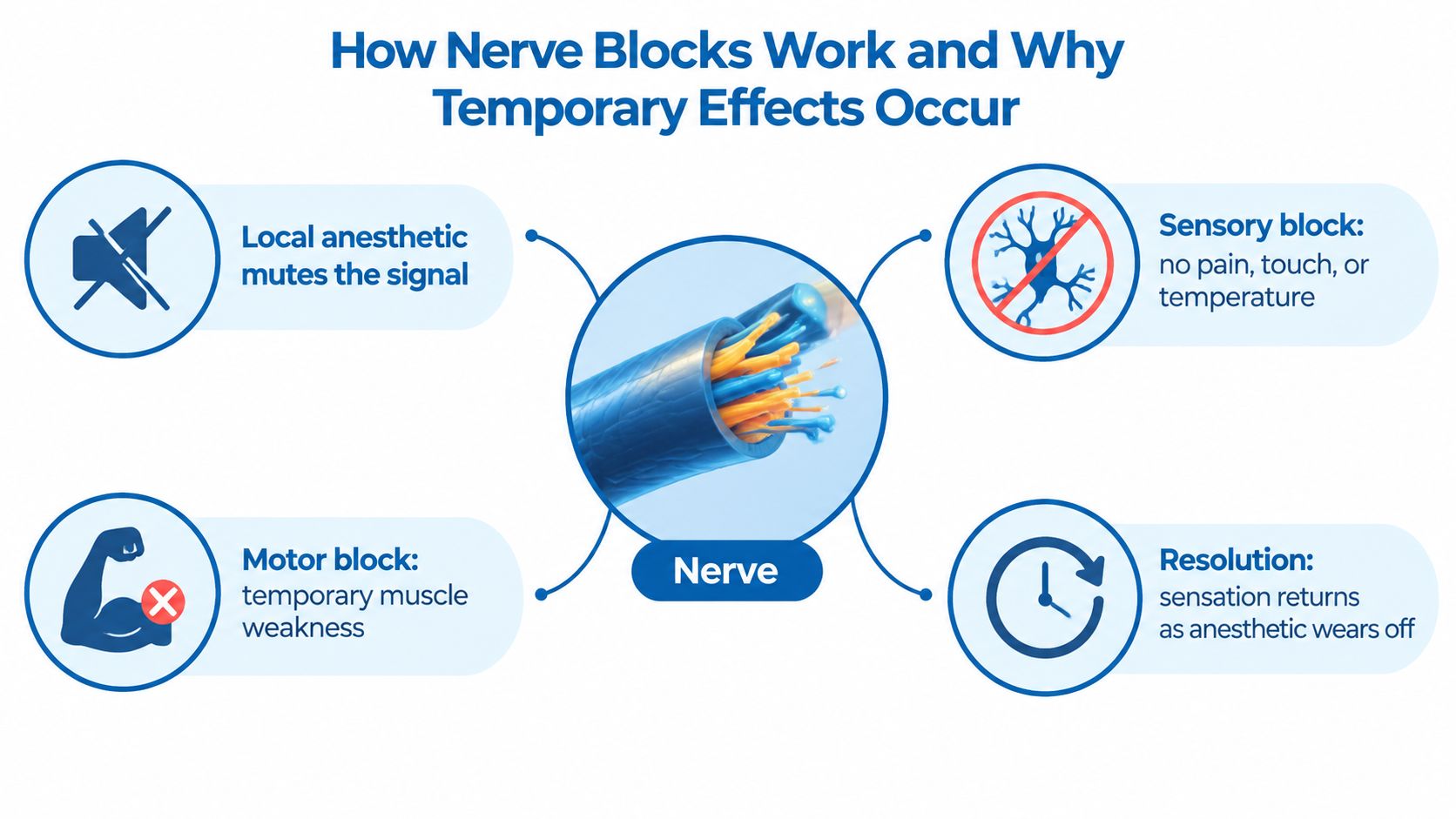 A diagram explaining how nerve blocks work by muting signals, causing temporary sensory and motor blocking effects.