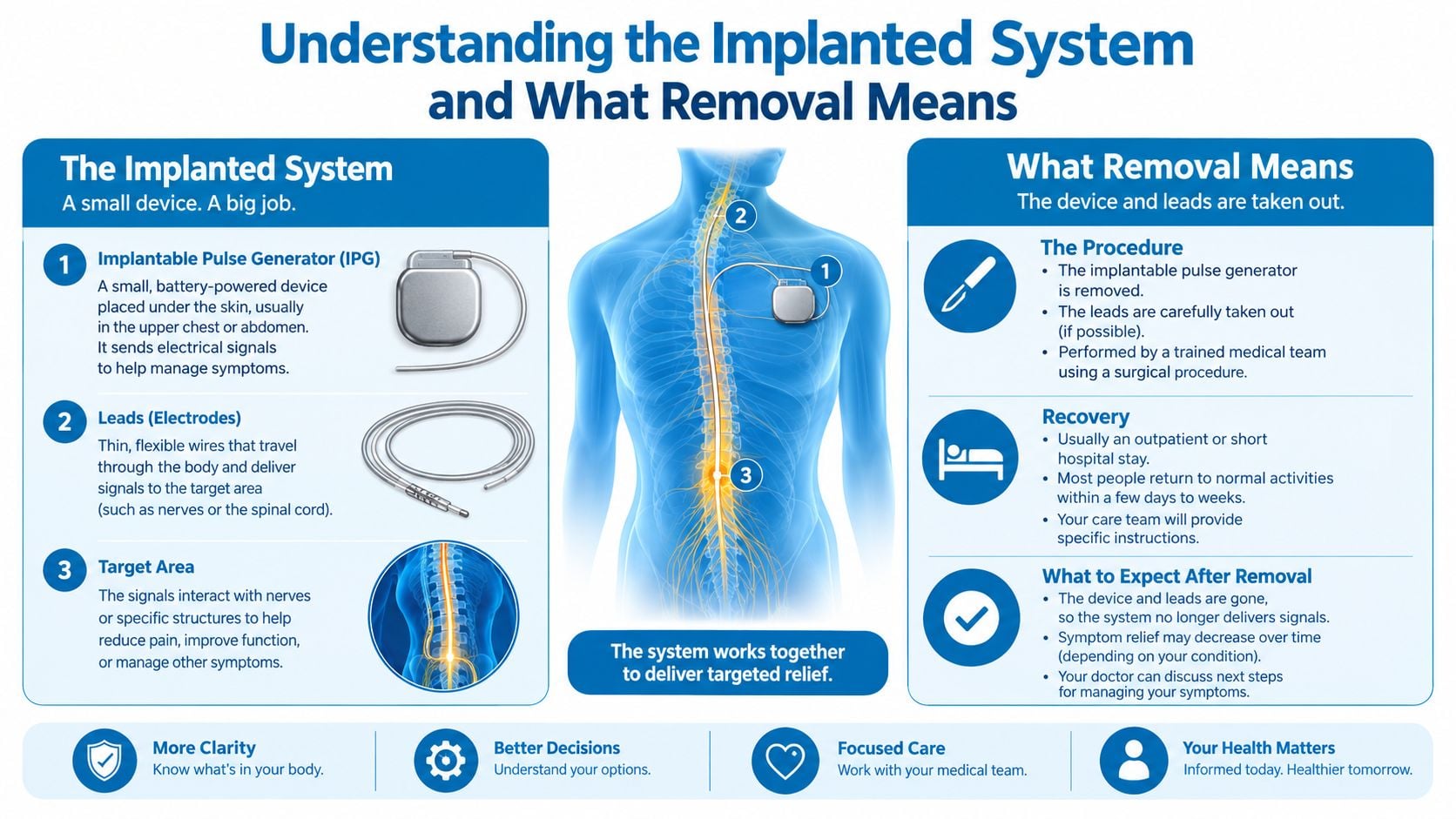 A diagram explaining an implanted medical system, its components, and the surgical process for its removal.